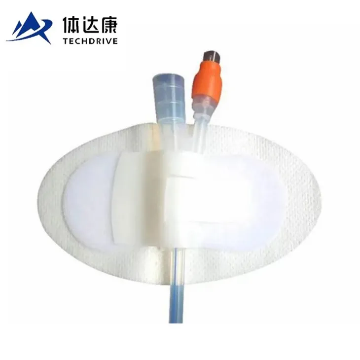 מכשיר קיבוע קטטר Foley למבוגרים C1